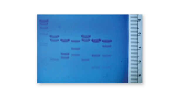 Gel electrophoresis