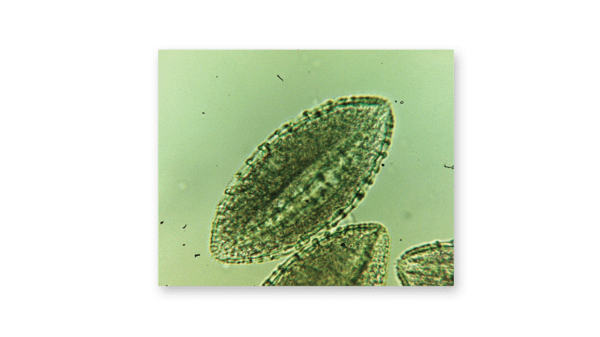 Lily pollen grain