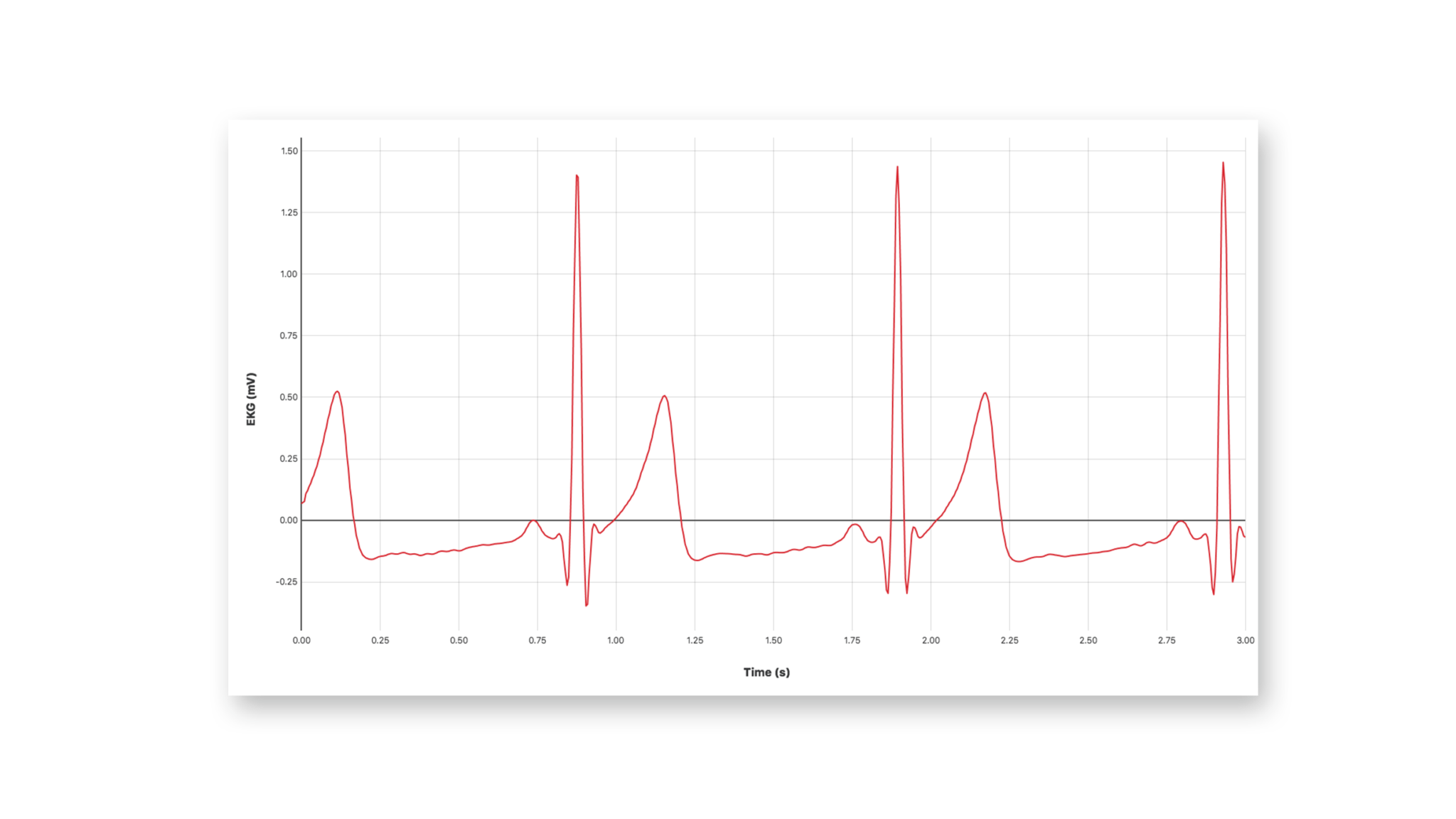 Go Direct® EKG Sensor Vernier