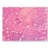 Kidney glomerulus at 150X