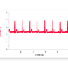 A series of EKG traces showing clear P, QRS, and T waves
