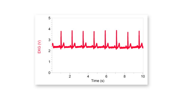 A series of EKG traces showing clear P, QRS, and T waves