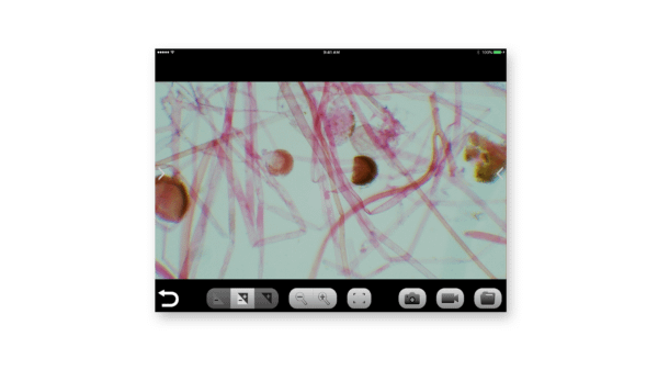 Zygomycota at 150x