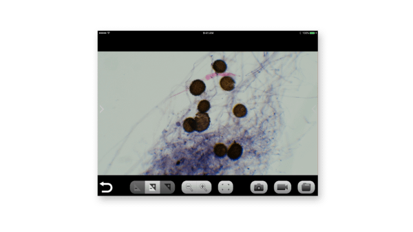 Zygomycota at 150x