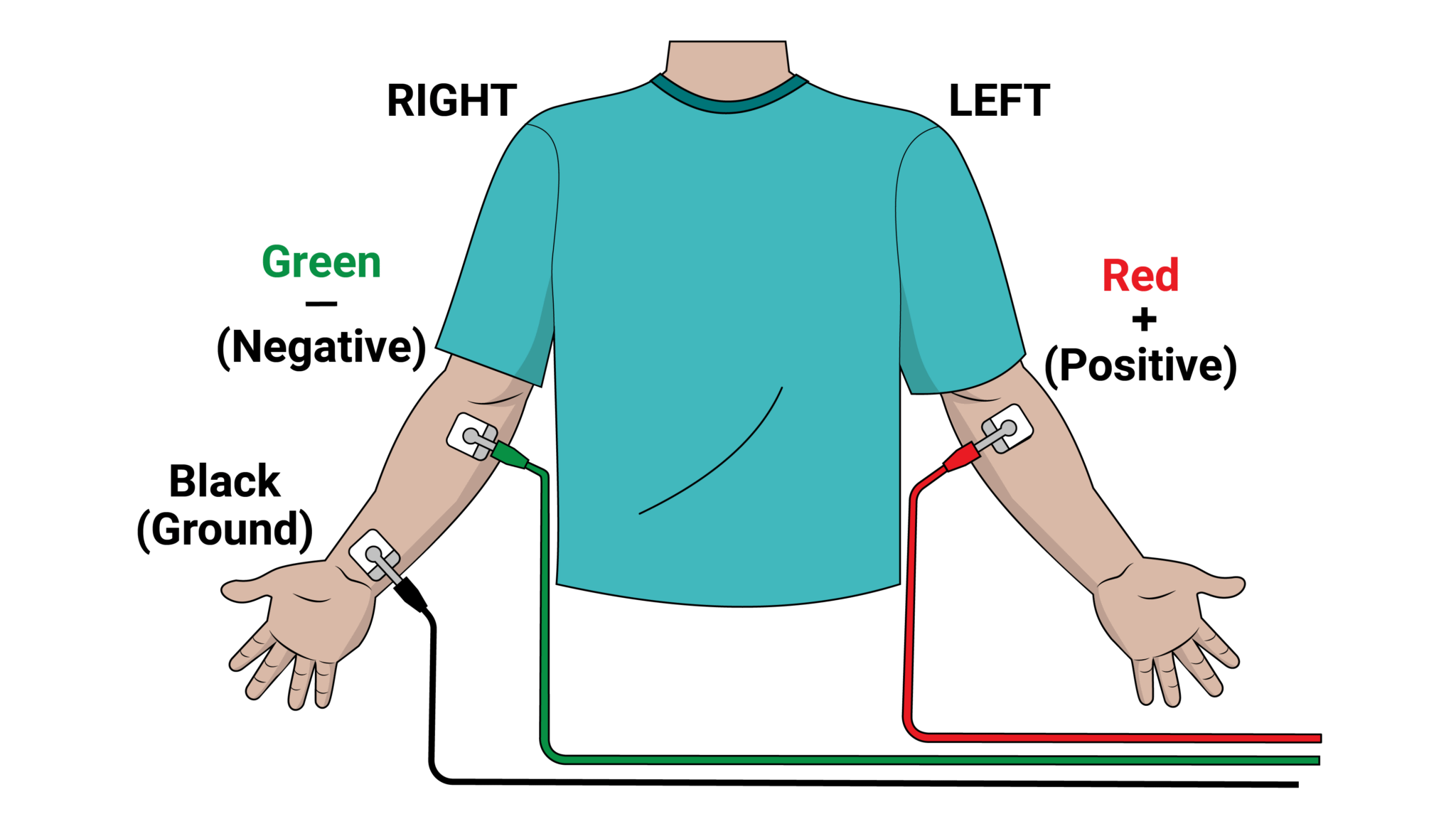 Answers to the Top Three Questions about the Go Direct® EKG Sensor